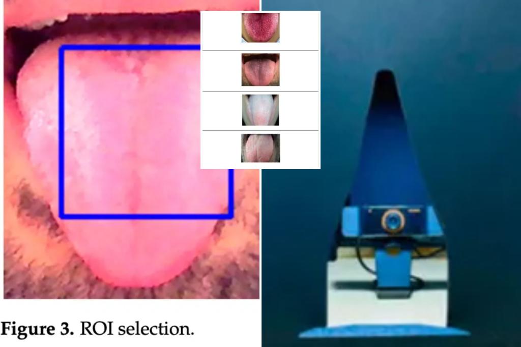 AI model 98% accurate in detecting diseases just by looking at your tongue